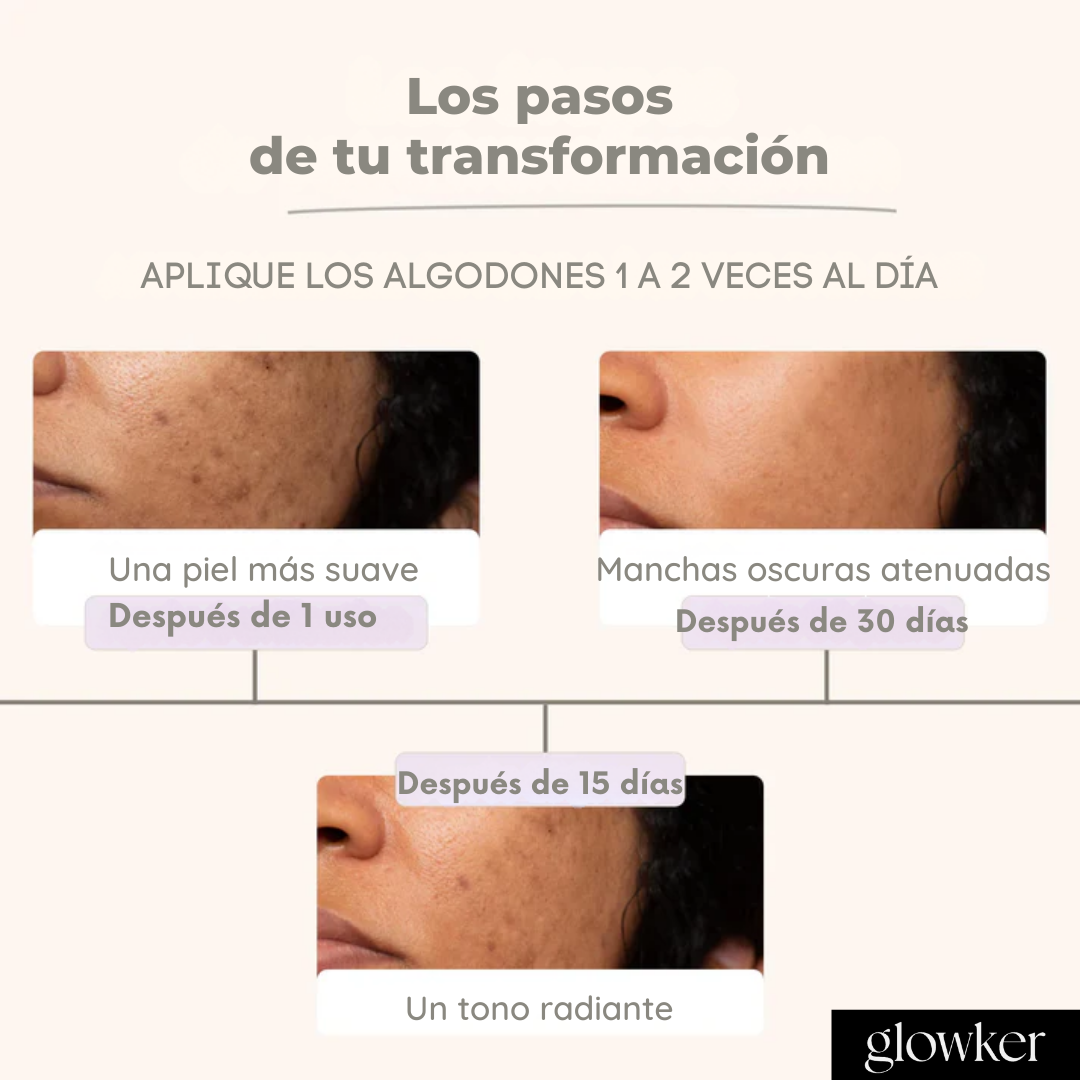 Discos anti-imperfecciones Glowker™ - Consigue una piel libre de manchas