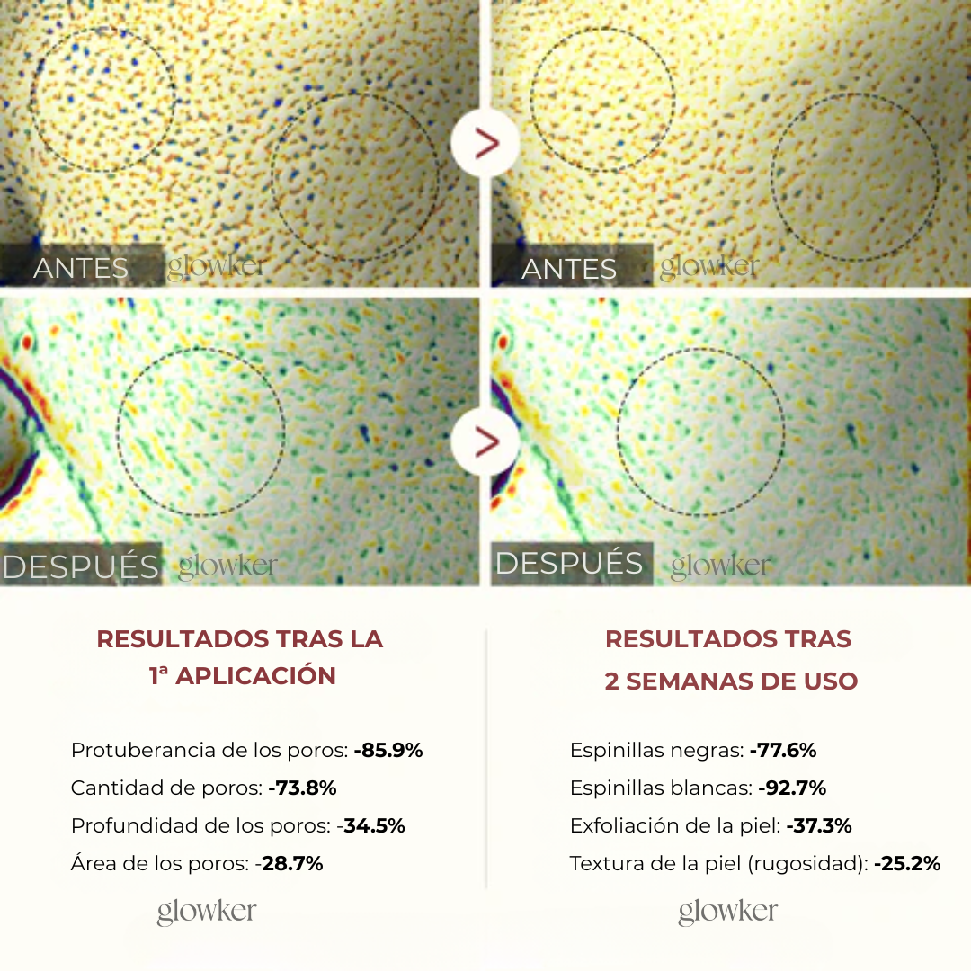 Doble Acción Exfoliante de Arroz – Piel Radiante, Suave y Sin Imperfecciones"