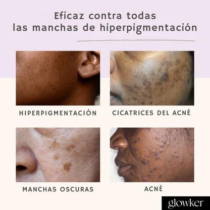 Discos anti-imperfecciones Glowker™ - Consigue una piel libre de manchas