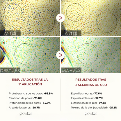 Doble Acción Exfoliante de Arroz – Piel Radiante, Suave y Sin Imperfecciones"